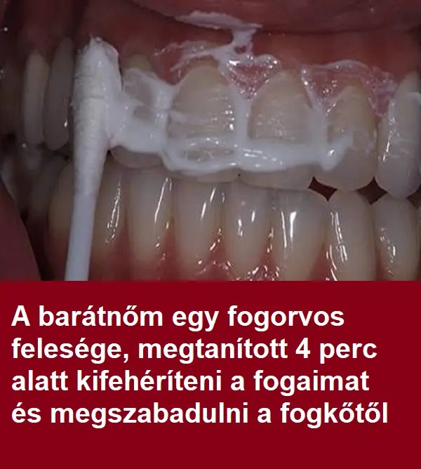 fogkő ellen fogkő ellen